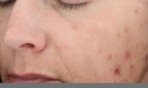 Med Spa Aesthetic Services