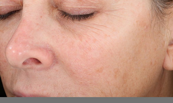 Med Spa Aesthetic Services