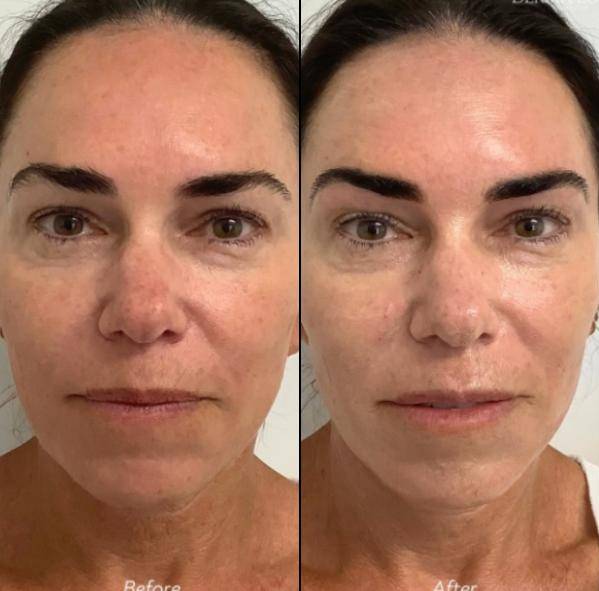 Diamond Glow | Case 2 