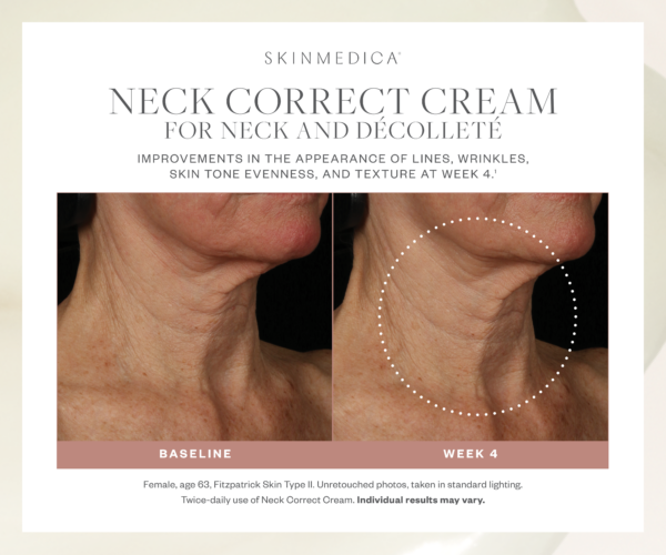 Neck Correct Cream - Image 4