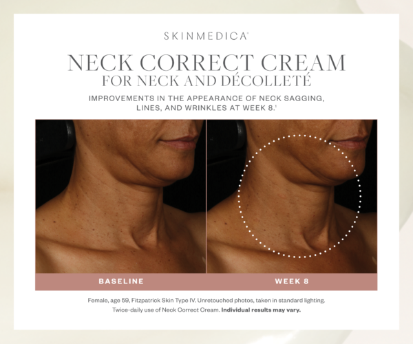 Neck Correct Cream - Image 5