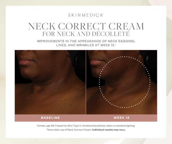 Neck Correct Cream - Image 3