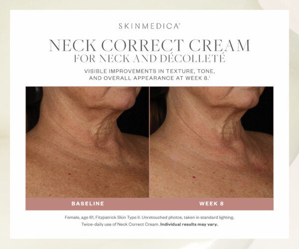 Neck Correct Cream - Image 6