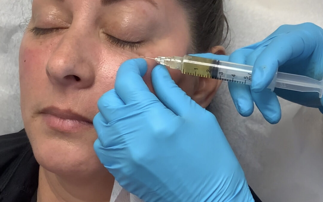 Natural Under Eye Rejuvenation