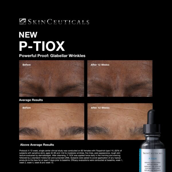 P-TIOX - Image 3