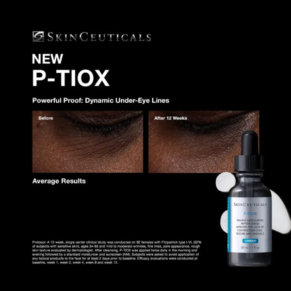 P-TIOX - Image 4