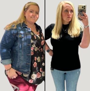Medical Weight Loss | Case 1