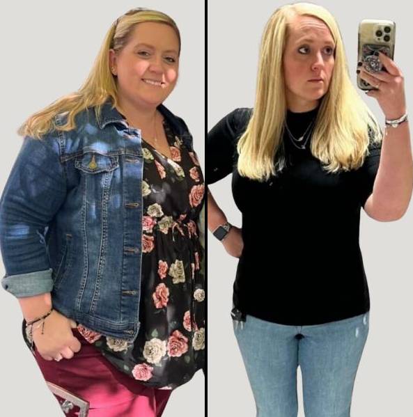 Medical Weight Loss | Case 1