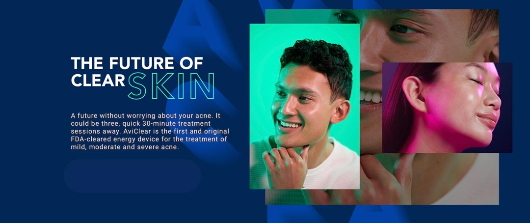 AviClear is the future of clear skin. AviClear is the future of clear skin.