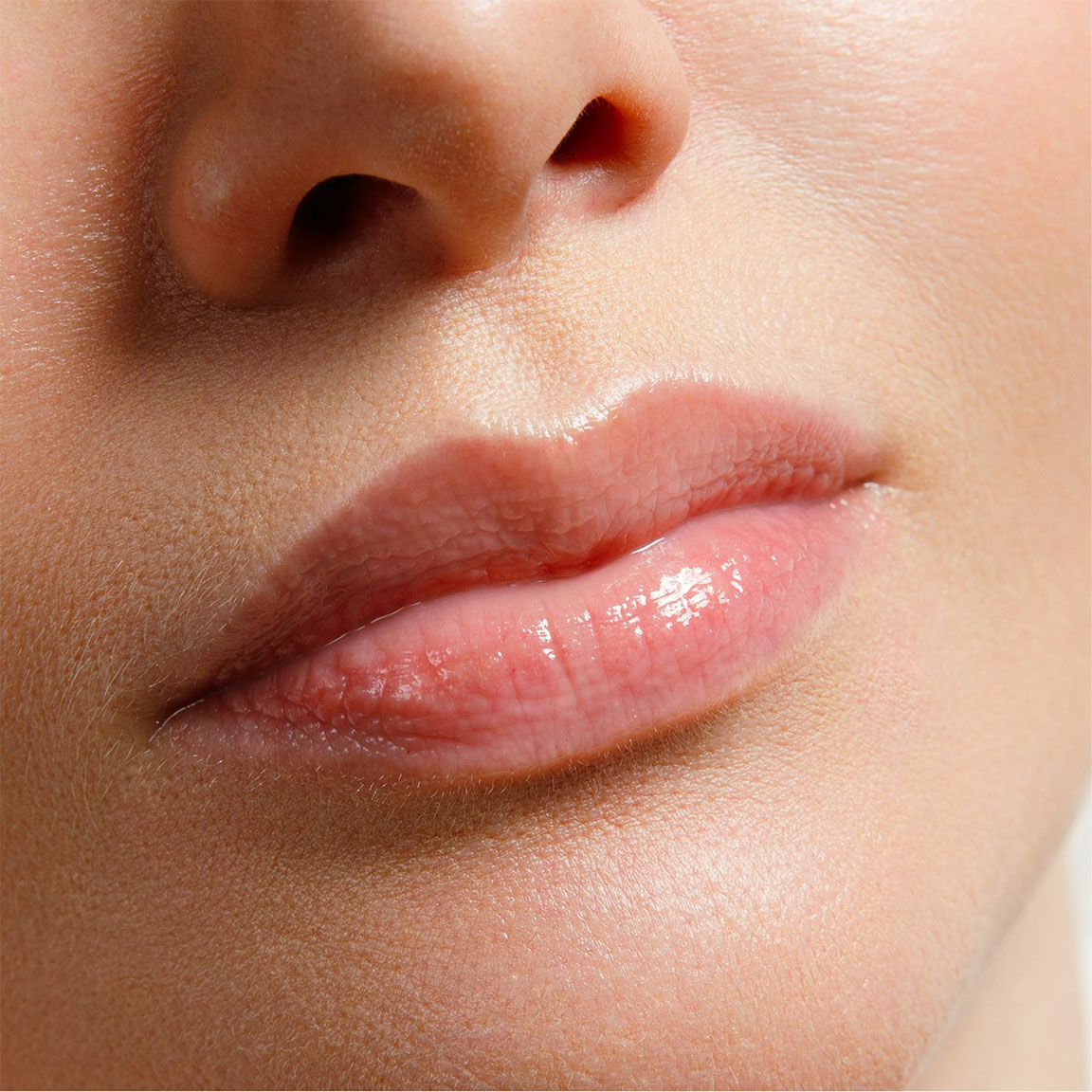 Lips after injections.