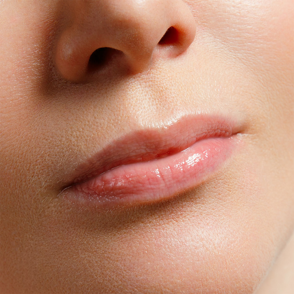 Lips before injections.